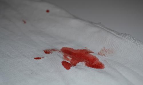 Ako odstrániť krv z oblečenia